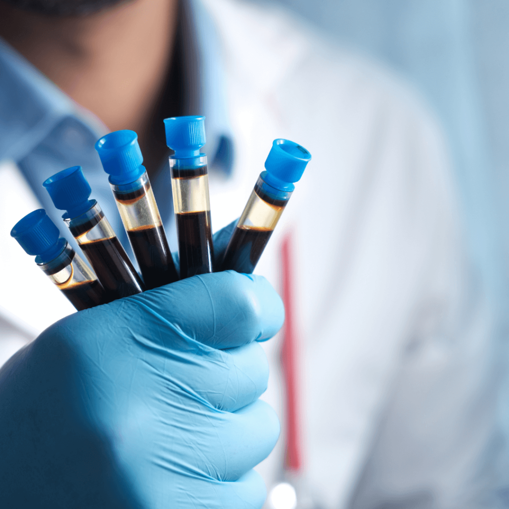 próbówki laboratoryjne z krwią Tłumaczenia medyczne z języka niemieckiego - dogadamycie.pl